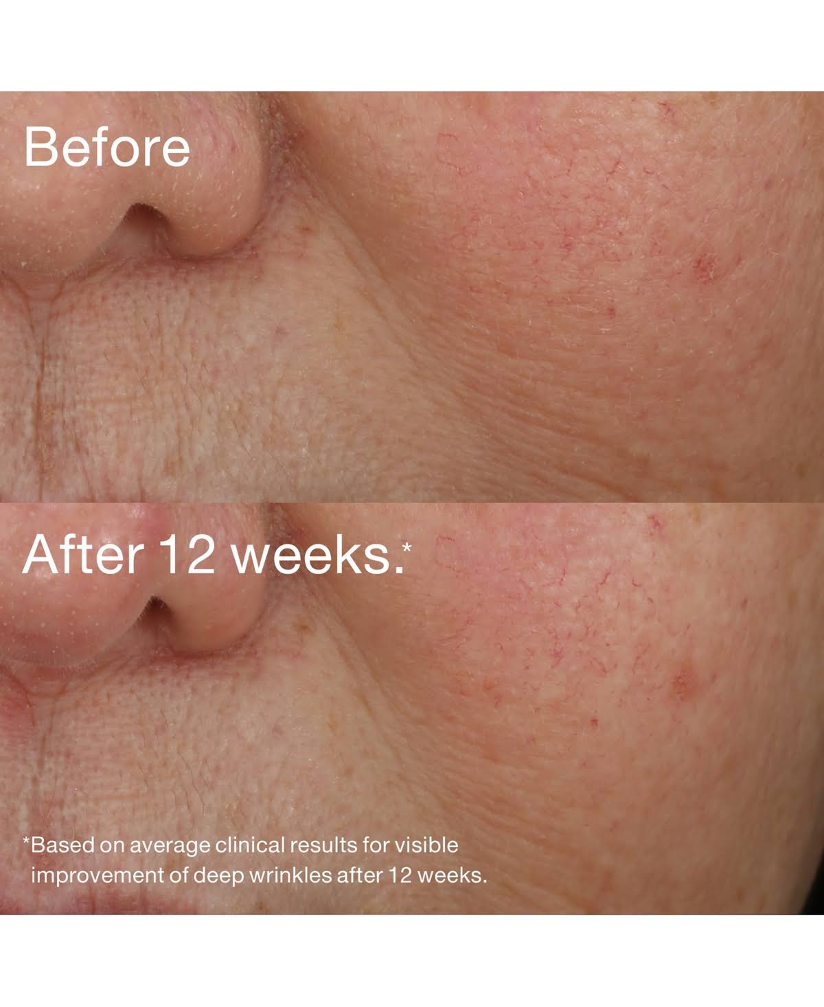 Retinol Night Repair Treatment I9112